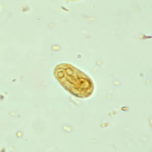 Giardia_cyst_wtmt5.jpg