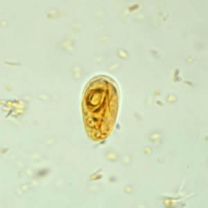 Giardia_cyst_wtmt6.jpg