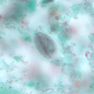 Giardia_cyst_tric10.jpg