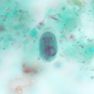 Giardia_cyst_tric4.jpg
