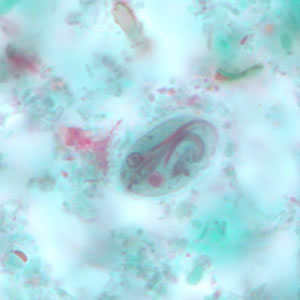 Giardia_cyst_tric6.jpg