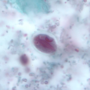 Giardia_cyst_tric8.jpg