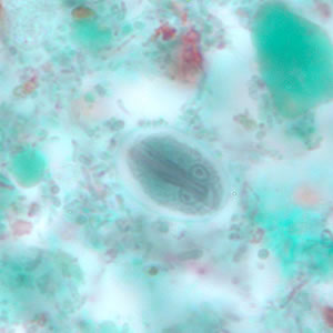 Giardia_cyst_tric9.jpg