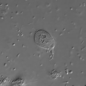Giardia_troph_dic.jpg