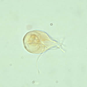 Giardia_troph_wtmt.jpg