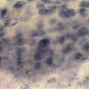 Giardia_troph_VT.jpg