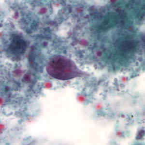 Giardia_troph_tric3.jpg