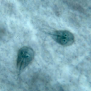 Giardia_troph_kohn.jpg