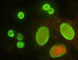 Giardia_cyst_IFA.jpg
