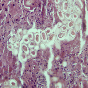 C_hepatica_eggs_200x_HB.jpg