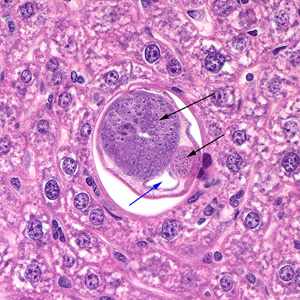 C_hepatica_400x_male_liver.jpg