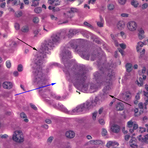C_hepatica_500x_liver.jpg