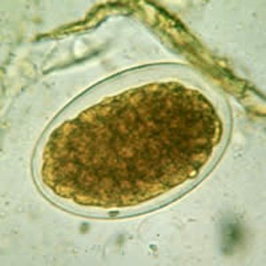 Hookworm_2x2_C.jpg