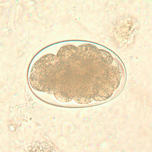 Hookworm_egg_BAM1.jpg