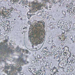 Hookworm_egg_BAM_MCS.jpg