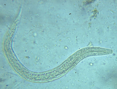 Hookworm_rhabditiform.jpg