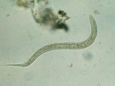 Hookworm_rhabditiform_2.jpg