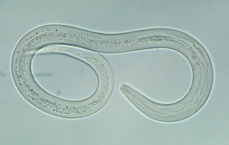 Hookworm_filariform_A.jpg