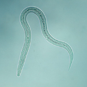 Hookworm_filariform_B.jpg