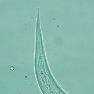 Hookworm_filariform_posterior_A.jpg