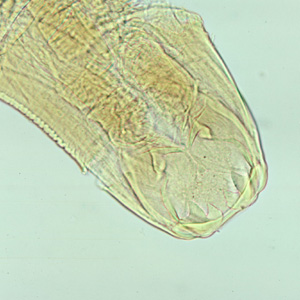 Aduodenale_head_A.jpg