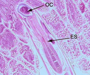 Hookworm_tissue_BAM1.jpg