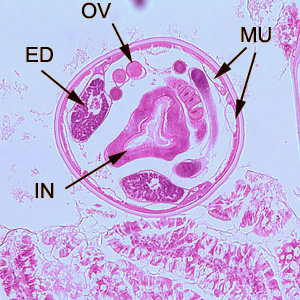 Hookworm_tissue_BAM2.jpg
