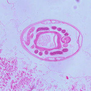 Hookworm_tissue_BAM3.jpg