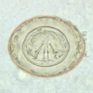 H_diminuta_egg_wtmt2.jpg