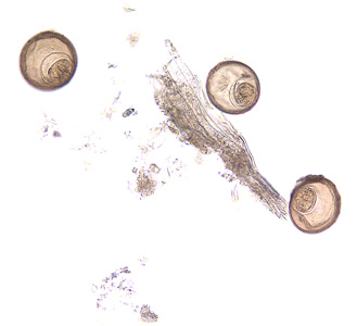 H_diminuta_eggs_BAM1.jpg