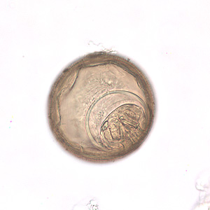 H_diminuta_eggs_BAM2.jpg