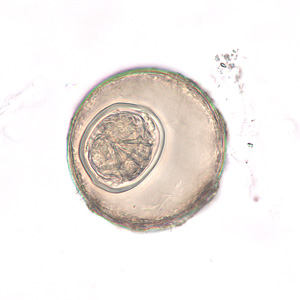 H_diminuta_eggs_BAM3.jpg