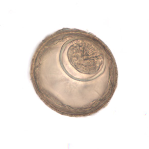 H_diminuta_eggs_BAM4.jpg