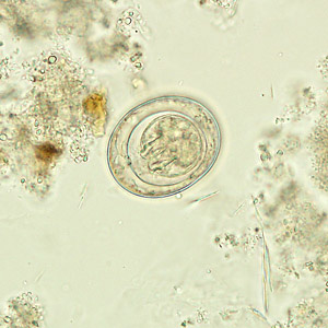 H_nana_HB2010.jpg