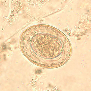 H_nana_egg_wtmt1.jpg