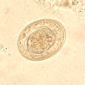 H_nana_egg_wtmt2.jpg