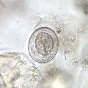 H_nana_egg_wtmt4.jpg