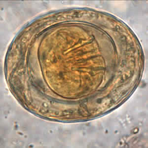 H_nana_egg_wtmt_OR.jpg