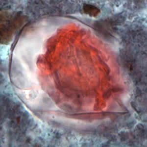 Hnana_egg_tric2_OR.jpg