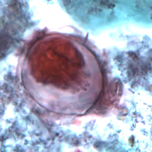 Hnana_egg_tric_OR.jpg