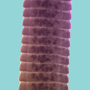 H_diminuta_proglottids_HE_BAM1.jpg