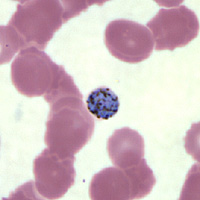 Case147_B.jpg