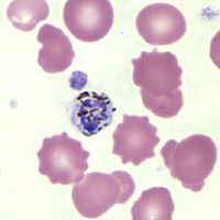 Case147_E.jpg