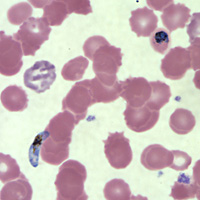 Case147_F.jpg