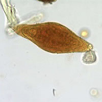 Case148_A.jpg