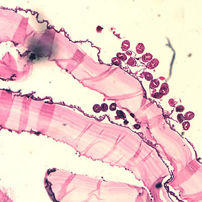 Case150_A.jpg
