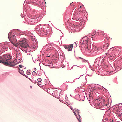 Case150_B.jpg