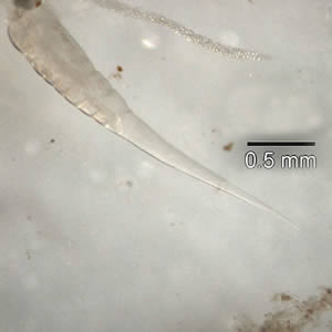 Case151_B.jpg
