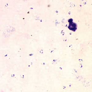 Case153_A.jpg