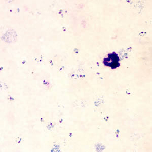 Case153_B.jpg